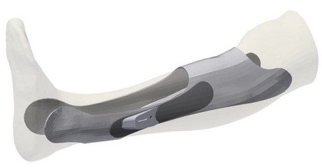 個性化加固設(shè)計的軟件工具 行業(yè)新聞 第3張