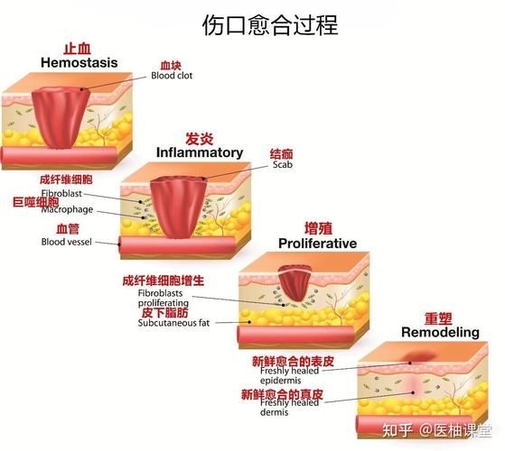 哪種補(bǔ)救方法副作用最??？ 行業(yè)新聞 第2張
