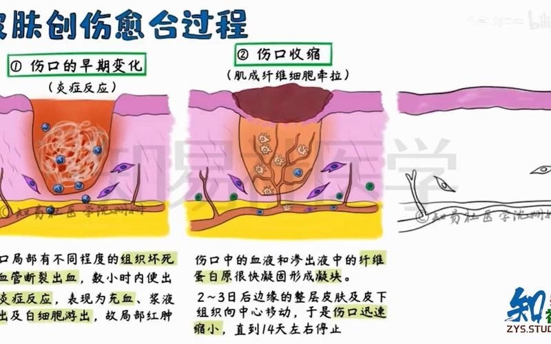 哪種補(bǔ)救方法副作用最小？ 行業(yè)新聞 第4張